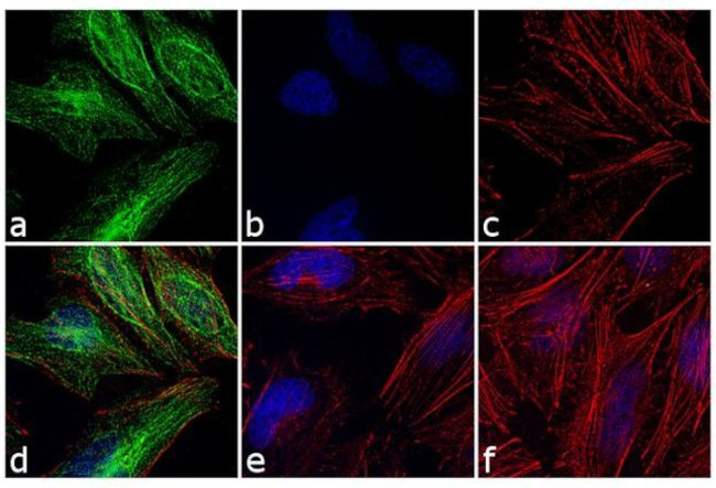 Rabbit IgG (H+L) Cross-Adsorbed Secondary Antibody in Immunocytochemistry (ICC/IF)