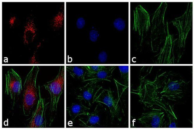 Rabbit IgG (H+L) Cross-Adsorbed Secondary Antibody in Immunocytochemistry (ICC/IF)