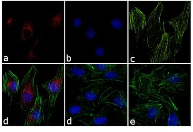 Rabbit IgG (H+L) Cross-Adsorbed Secondary Antibody in Immunocytochemistry (ICC/IF)