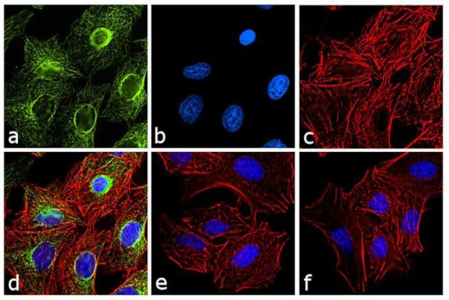 Rat IgG (H+L) Cross-Adsorbed Secondary Antibody in Immunocytochemistry (ICC/IF)