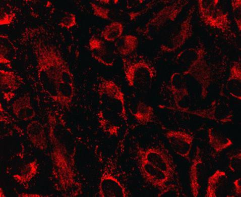 HSDL2 Antibody in Immunocytochemistry (ICC/IF)