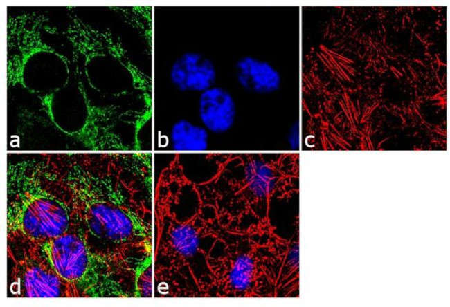 SOD2 Antibody in Immunocytochemistry (ICC/IF)