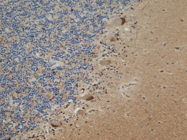 SOD2 Antibody in Immunohistochemistry (Paraffin) (IHC (P))