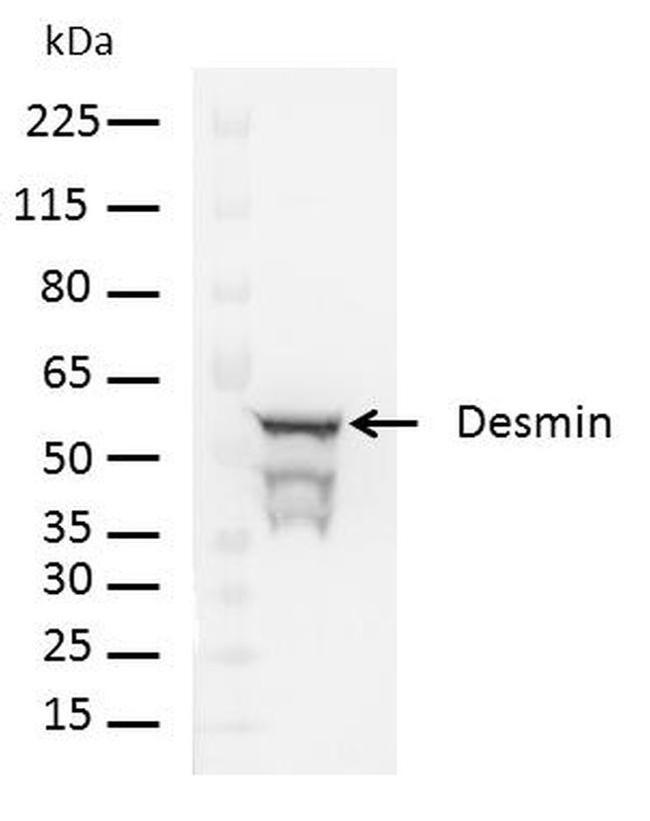 Rabbit IgG (H+L) Cross-Adsorbed Secondary Antibody in Western Blot (WB)