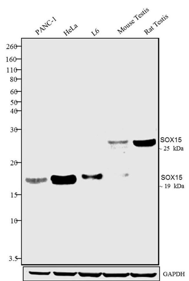 Rabbit IgG (Heavy chain) Secondary Antibody in Western Blot (WB)