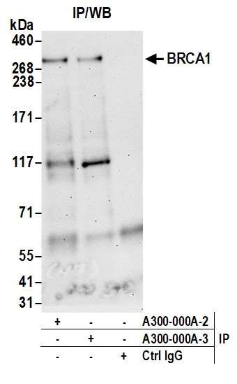 BRCA1 Antibody in Immunoprecipitation (IP)