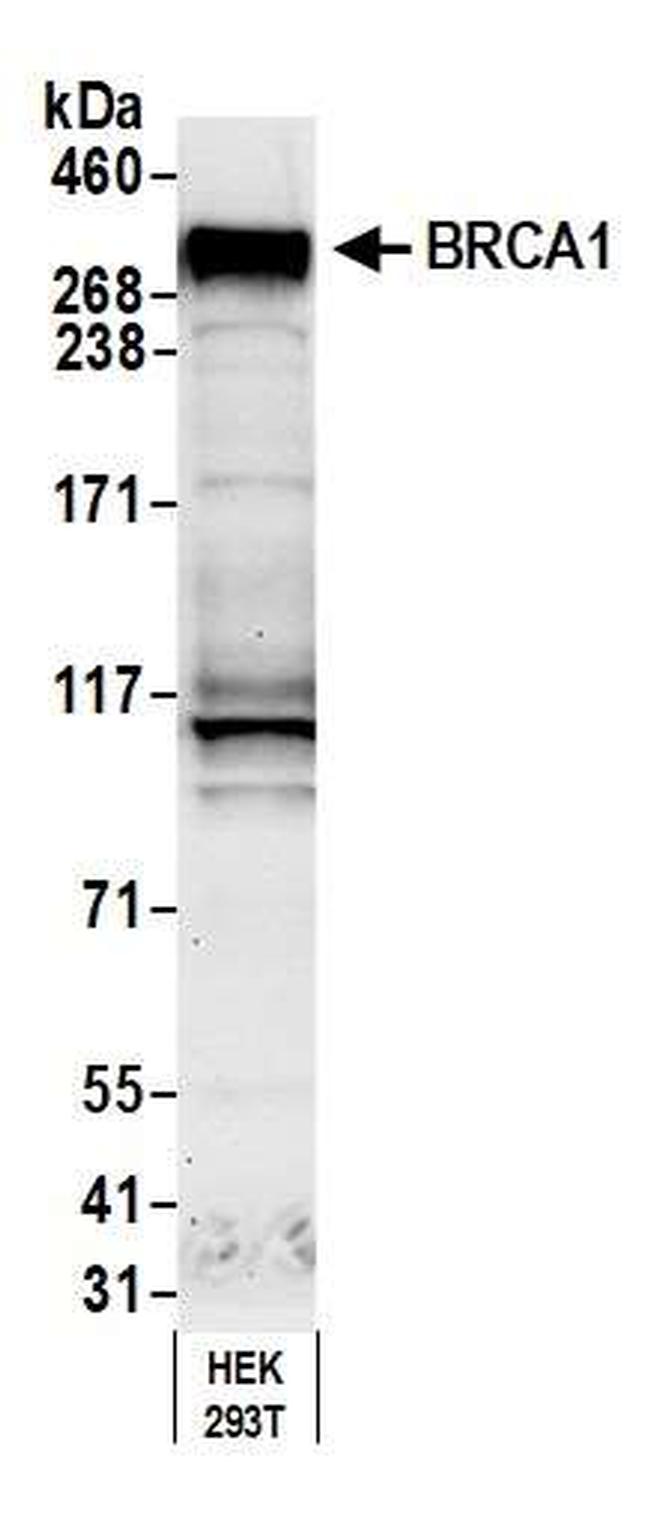 BRCA1 Antibody in Western Blot (WB)