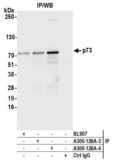 p73 Antibody in Immunoprecipitation (IP)