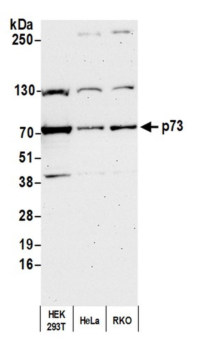 p73 Antibody in Western Blot (WB)