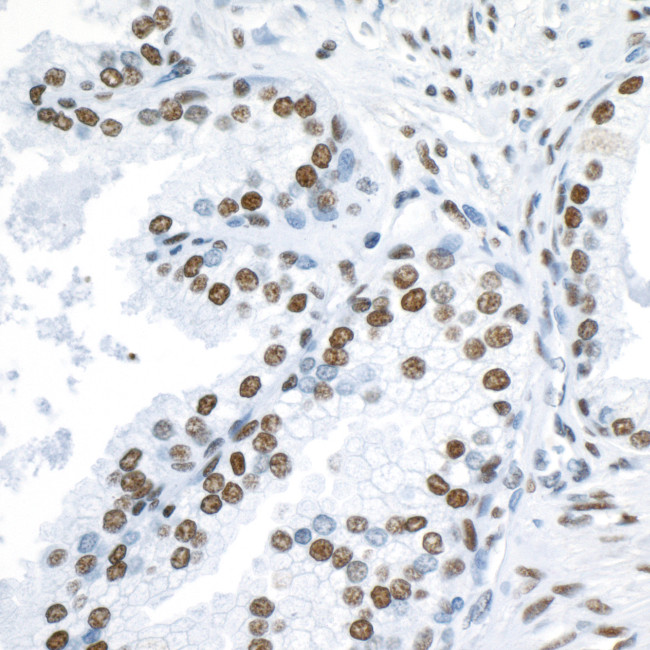 53BP1 Antibody in Immunohistochemistry (Paraffin) (IHC (P))