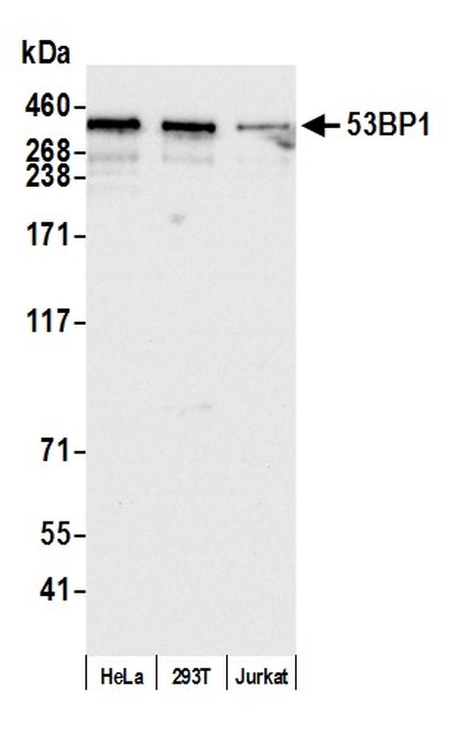 53BP1 Antibody in Western Blot (WB)