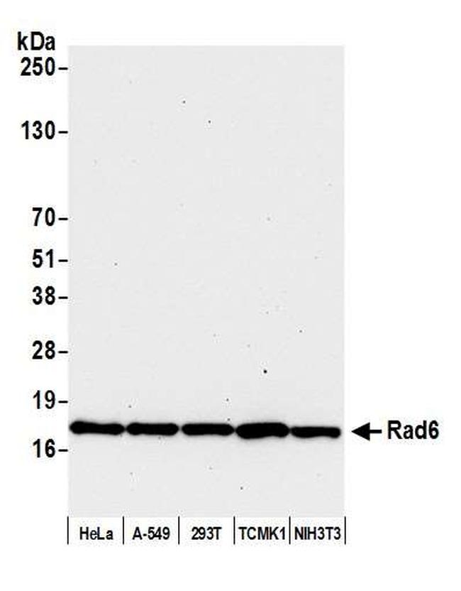 Rad6 Antibody in Western Blot (WB)