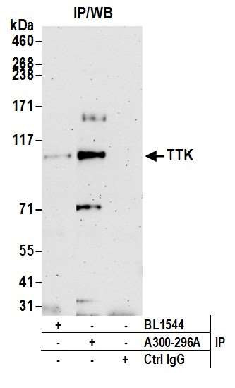 TTK Antibody in Immunoprecipitation (IP)