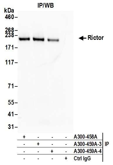 Rictor Antibody in Immunoprecipitation (IP)