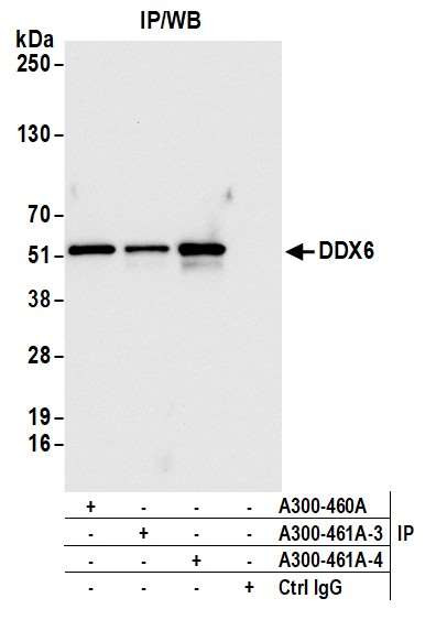 DDX6 Antibody in Immunoprecipitation (IP)