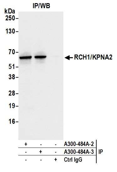 RCH1/KPNA2 Antibody in Immunoprecipitation (IP)