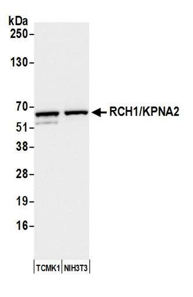 RCH1/KPNA2 Antibody in Western Blot (WB)