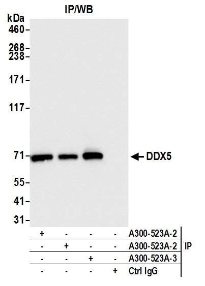DDX5 Antibody in Immunoprecipitation (IP)