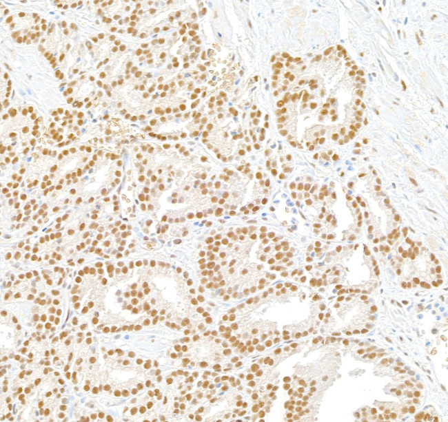 BTF Antibody in Immunohistochemistry (Paraffin) (IHC (P))