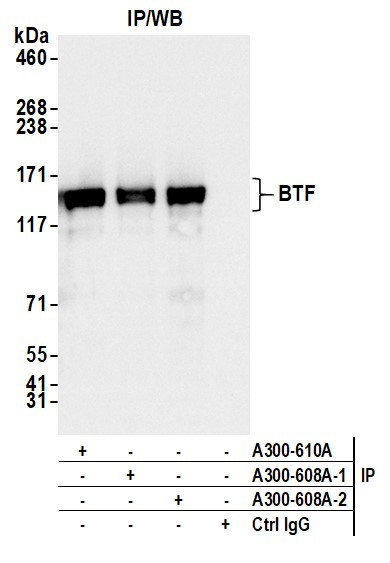 BTF Antibody in Immunoprecipitation (IP)