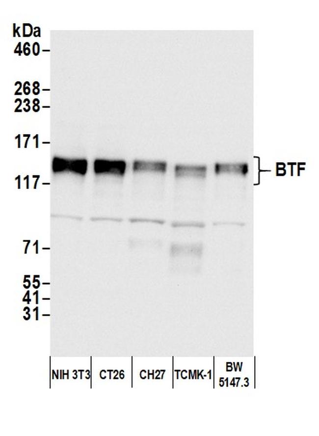 BTF Antibody in Western Blot (WB)