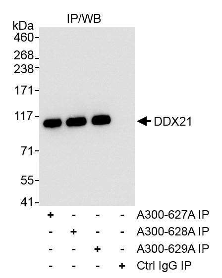 DDX21 Antibody in Immunoprecipitation (IP)