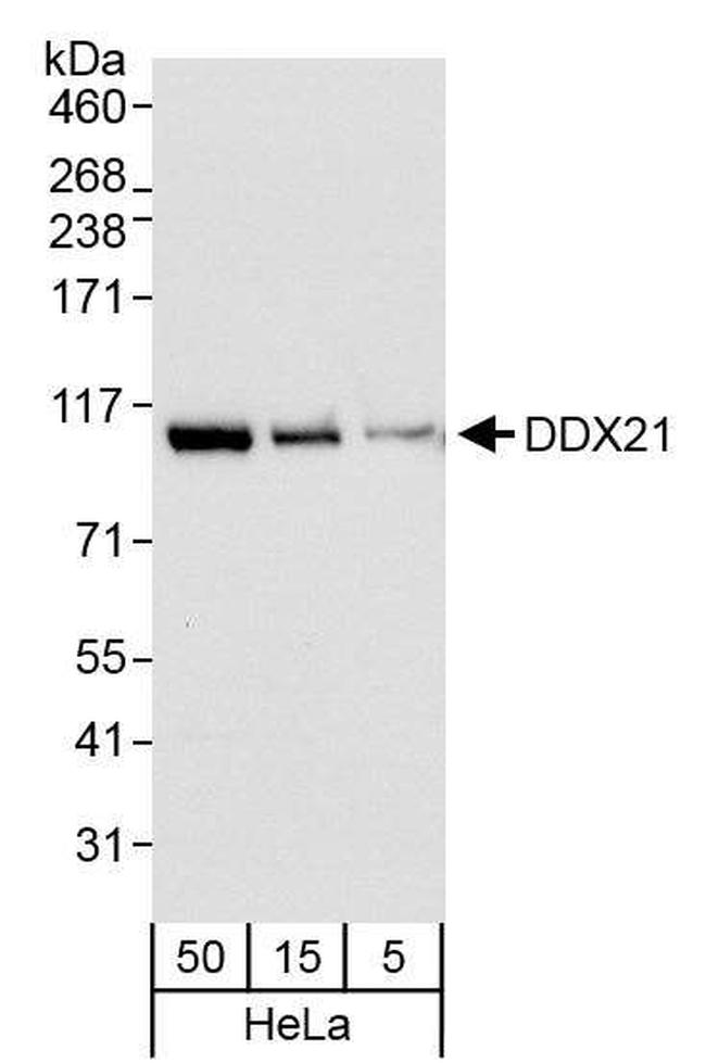 DDX21 Antibody in Western Blot (WB)