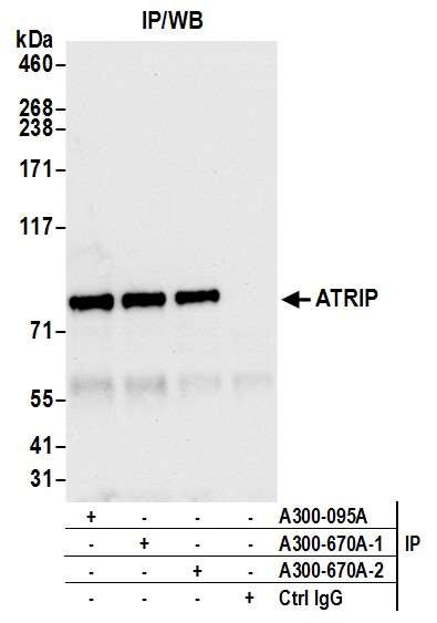 ATRIP Antibody in Immunoprecipitation (IP)