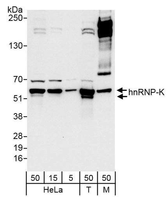 hnRNP-K Antibody in Western Blot (WB)