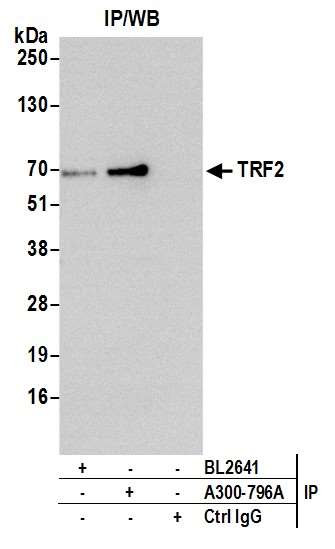 TRF2 Antibody in Immunoprecipitation (IP)