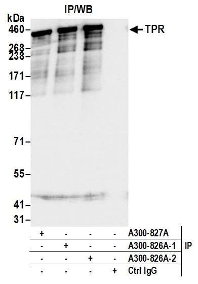 TPR Antibody in Immunoprecipitation (IP)