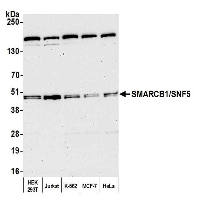 SMARCB1/SNF5 Antibody in Western Blot (WB)