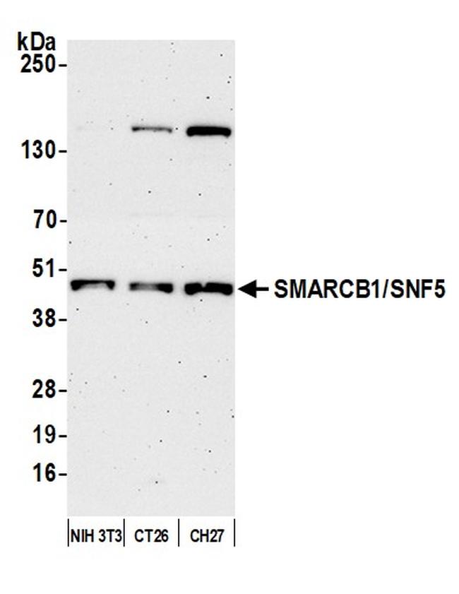 SMARCB1/SNF5 Antibody in Western Blot (WB)