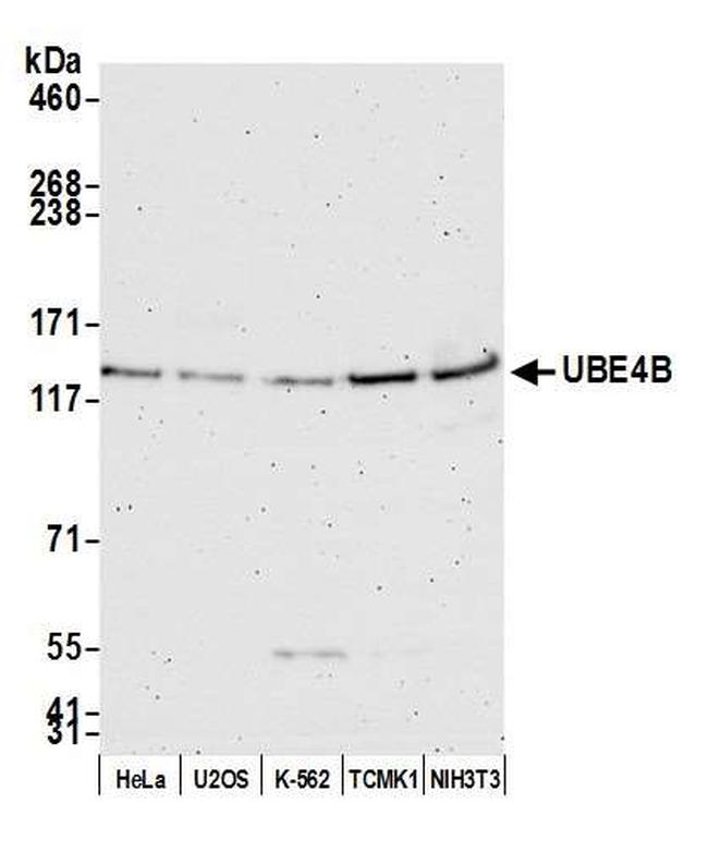 UBE4B Antibody in Western Blot (WB)