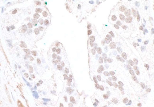 FBW7 Antibody in Immunohistochemistry (Paraffin) (IHC (P))
