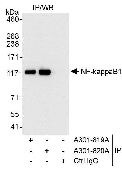 NF-kappaB1 Antibody in Immunoprecipitation (IP)