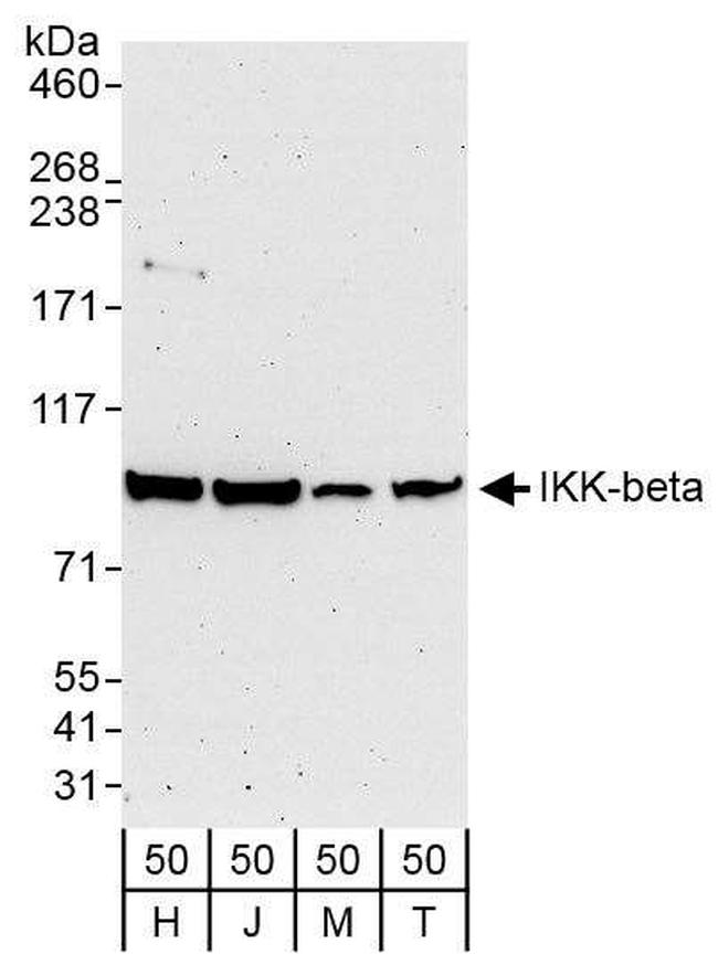 IKK-beta Antibody in Western Blot (WB)