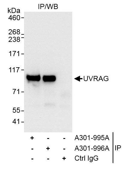 UVRAG Antibody in Immunoprecipitation (IP)
