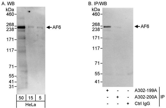 AF6 Antibody in Western Blot (WB)