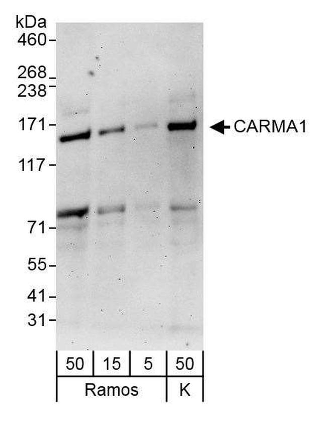 CARMA1 Antibody in Western Blot (WB)