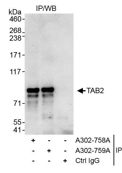 TAB2 Antibody in Immunoprecipitation (IP)