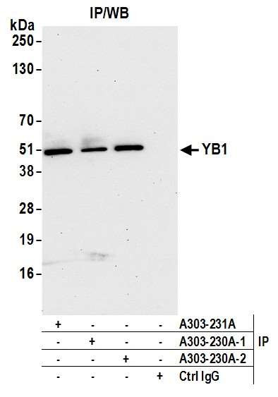 YB1 Antibody in Immunoprecipitation (IP)