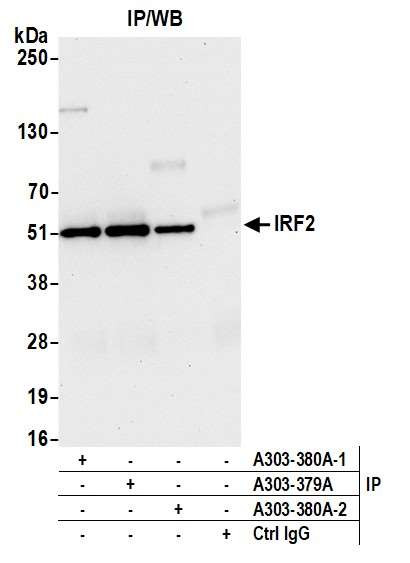 IRF2 Antibody in Immunoprecipitation (IP)