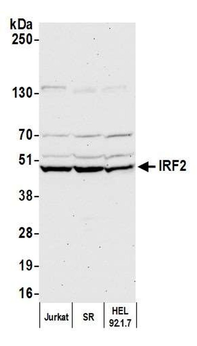 IRF2 Antibody in Western Blot (WB)