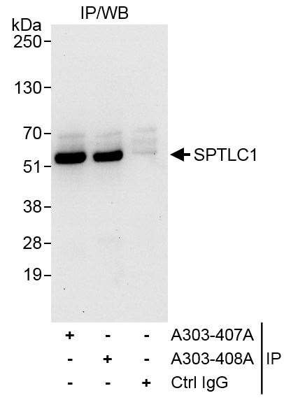 SPTLC1 Antibody in Immunoprecipitation (IP)