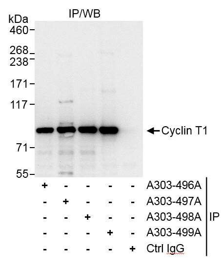 Cyclin T1 Antibody in Immunoprecipitation (IP)