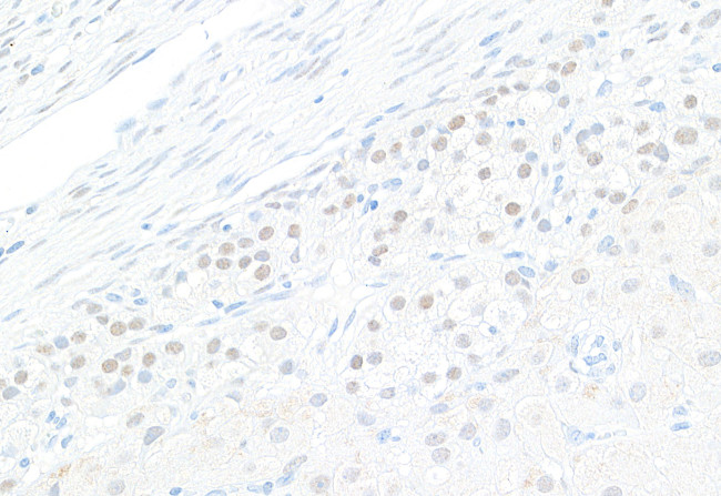 GATA4 Antibody in Immunohistochemistry (Paraffin) (IHC (P))