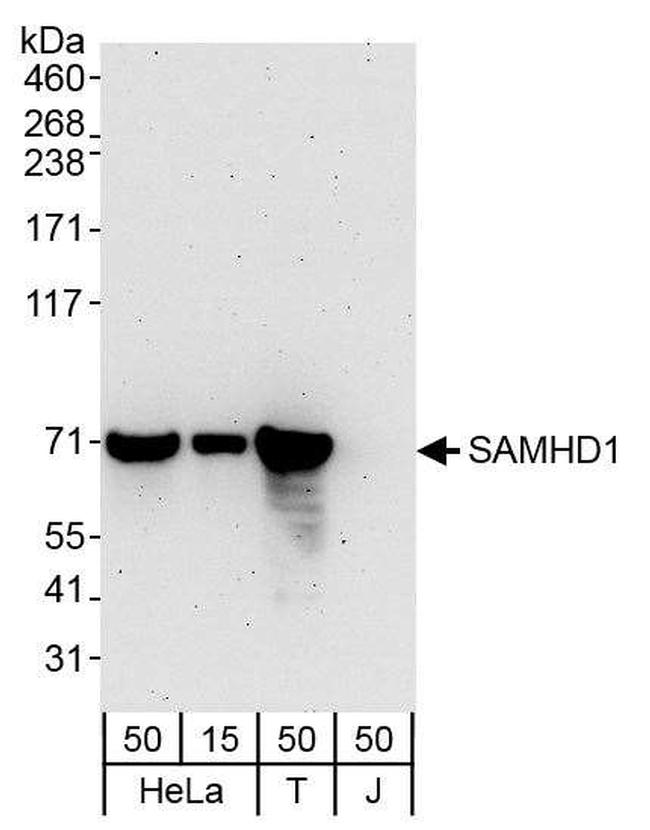 SAMHD1 Antibody in Western Blot (WB)