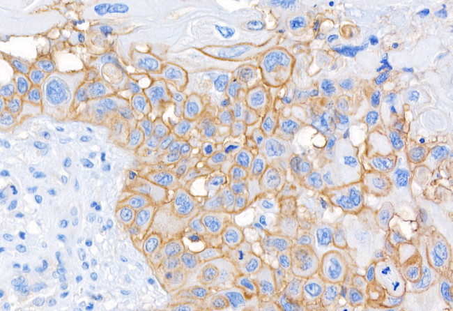 CD44 Antibody in Immunohistochemistry (Paraffin) (IHC (P))