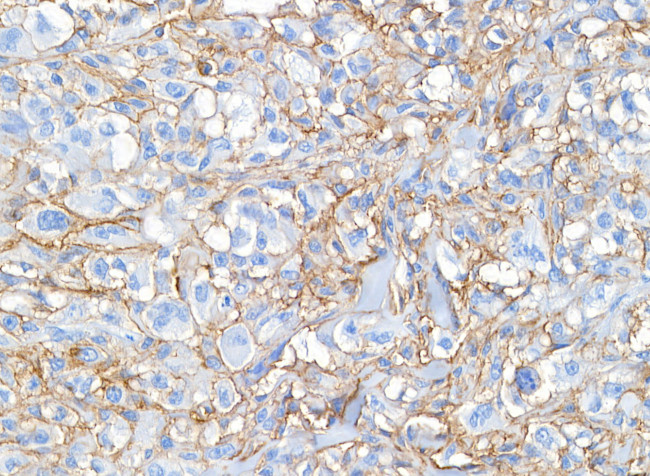 CD44 Antibody in Immunohistochemistry (Paraffin) (IHC (P))